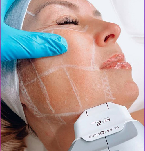 estetica-botox-facial